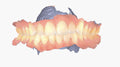 Shining 3D Aoralscan Elite Intraoral Dental 3D Scanner